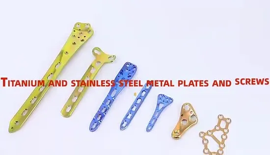 Distal Dorsal Plate of Radius Titanium Fracture Full Types Implant Orthopedic Instruments Plate